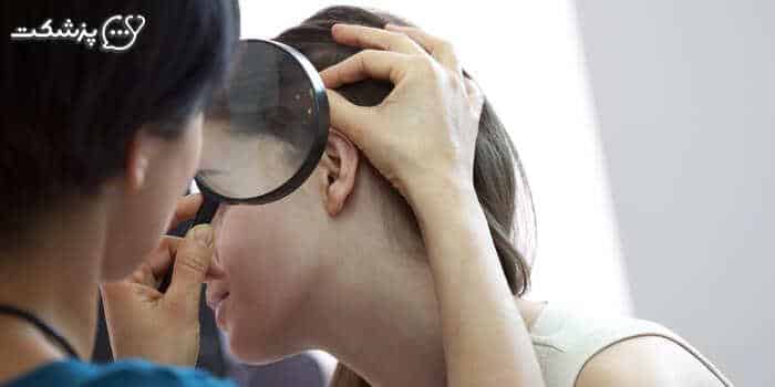 فولیکولیت و برامدگی سر-پزشکت